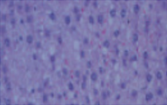 술을 2주 동안 섭취한 쥐의 간